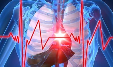 Effetto negativo dell'alcol sul cuore